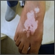 Dermatology (Skin)